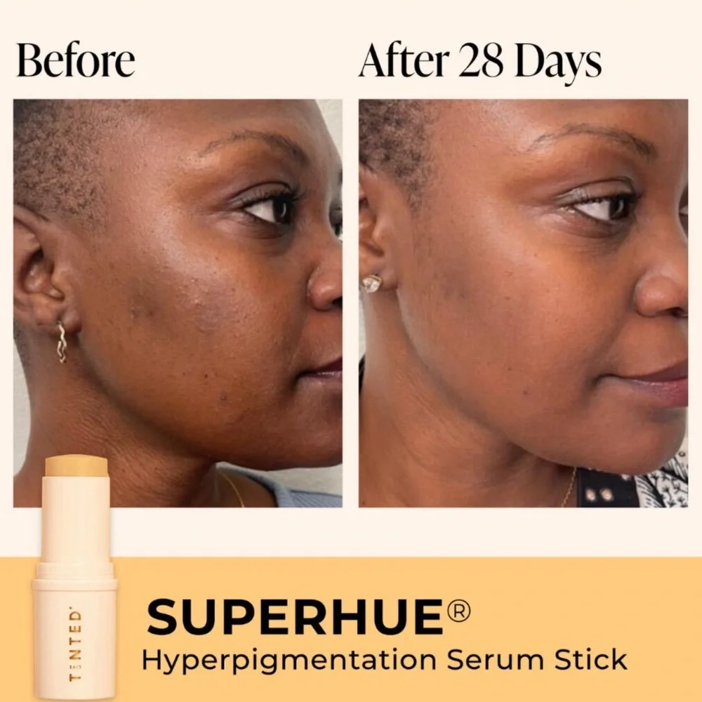 $9❤️‍🔥 Live Tinted Superhue Hyperpigmentation Serum Stick 🪞 NEW IN BOX